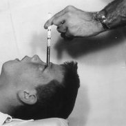 The rise and fall of the prefrontal lobotomy